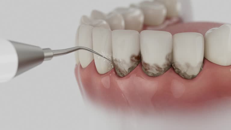 Trusted Dental Implants service in Weston, NJ - Dentist Open Now